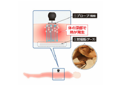 「秋から目指したい肌」について、お客様の声