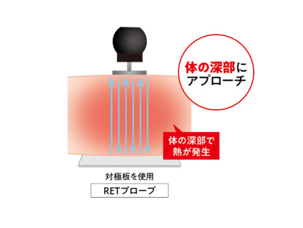 デトックスの季節